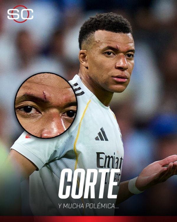 正规线上配资 血洒球场！ESPN晒姆巴佩伤口图，伤痕明显有些肿